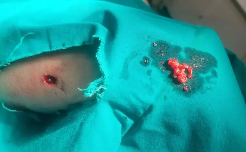 masno tkivo masno tkivo