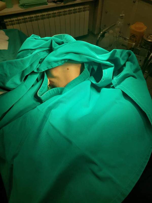 Uklanjanje Mladeža Uklanjanje Mladeža