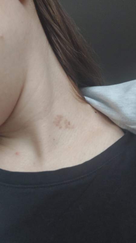 Uklonjen Mladež Uklonjen Mladež