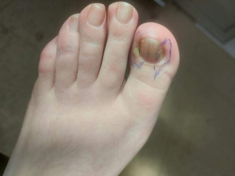 urastao nokat urastao nokat